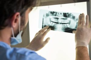 Close-up image of a dentist examining a dental X-ray plate, focusing on the dentist's face and the X-ray plate in hand, illustrating the process of dental examination and diagnosis.